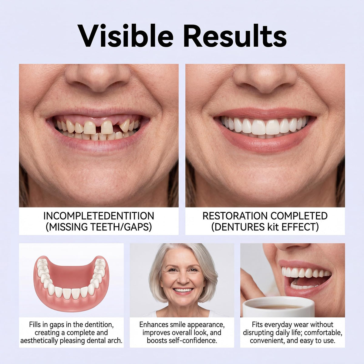 Heat Moldable Silicone Denture Kit Q125